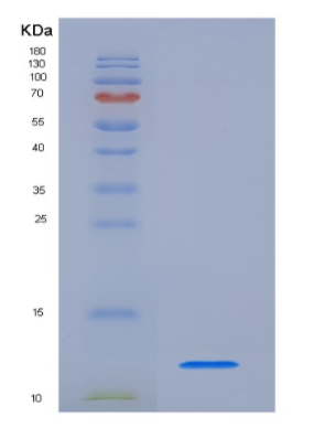 Eukaryotic Chemokine (C-X-C Motif) Ligand 1 (CXCL1),Eukaryotic Chemokine (C-X-C Motif) Ligand 1 (CXCL1)