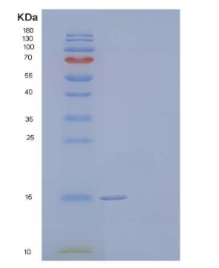 Recombinant Human Hemoglobin Subunit α/HBA1 Protein(N-6His),Recombinant Human Hemoglobin Subunit α/HBA1 Protein(N-6His)