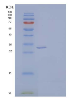 Recombinant Human CLEC10A/CD301 Protein(C-6His),Recombinant Human CLEC10A/CD301 Protein(C-6His)