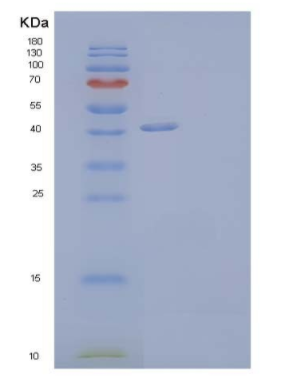 Recombinant Human Nogo-66 Receptor-Related 3/NgR3/RTN4RL1 Protein(C-6His),Recombinant Human Nogo-66 Receptor-Related 3/NgR3/RTN4RL1 Protein(C-6His)