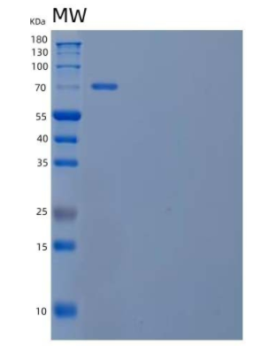 Recombinant Human Neuroligin 4, X-Linked/NLGN4X Protein(C-6His),Recombinant Human Neuroligin 4, X-Linked/NLGN4X Protein(C-6His)