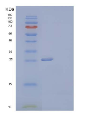 Recombinant Human Coagulation Factor III/Tissue Factor/CD142 Protein(C-6His),Recombinant Human Coagulation Factor III/Tissue Factor/CD142 Protein(C-6His)