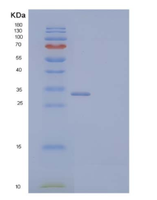 Recombinant Mouse Exostosin-Like 2/EXTL2 Protein(N-6His),Recombinant Mouse Exostosin-Like 2/EXTL2 Protein(N-6His)