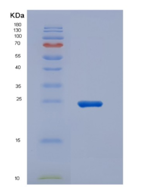 Recombinant High Mobility Group Protein 1 (HMGB1),Recombinant High Mobility Group Protein 1 (HMGB1)