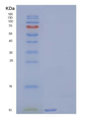 Recombinant Human Complement Component C3a/C3a Protein,Recombinant Human Complement Component C3a/C3a Protein