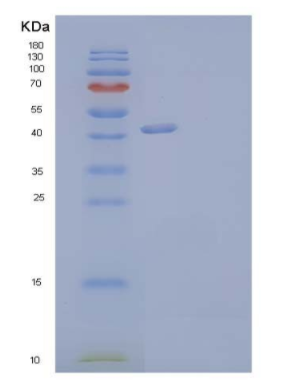 Recombinant Human Neutrophil Cytosol Factor 1/ NCF1 Protein,Recombinant Human Neutrophil Cytosol Factor 1/ NCF1 Protein