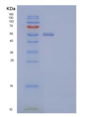 Recombinant Human Host Cell Factor 2/HCFC2 Protein(N-6His),Recombinant Human Host Cell Factor 2/HCFC2 Protein(N-6His)