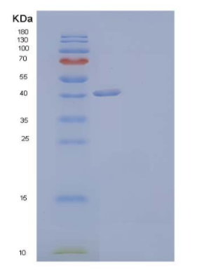 Recombinant Human THSD1/TMTSP Protein(C-6His),Recombinant Human THSD1/TMTSP Protein(C-6His)