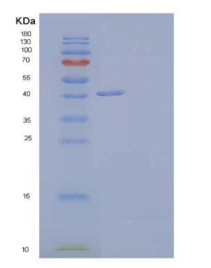 Recombinant Human Hyaluronidase-1/HYAL1 Protein(C-6His),Recombinant Human Hyaluronidase-1/HYAL1 Protein(C-6His)