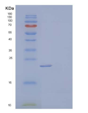 Recombinant Human Complement Component C8 γ Chain/C8G Protein(N-6His),Recombinant Human Complement Component C8 γ Chain/C8G Protein(N-6His)