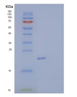 Recombinant Human Thymopoietin/TMPO/LAP2 Protein(C-6His),Recombinant Human Thymopoietin/TMPO/LAP2 Protein(C-6His)
