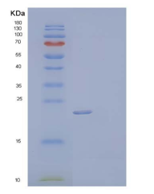 Recombinant Human Tissue Inhibitor of Metalloproteinases 2/TIMP-2 Protein(C-6His),Recombinant Human Tissue Inhibitor of Metalloproteinases 2/TIMP-2 Protein(C-6His)