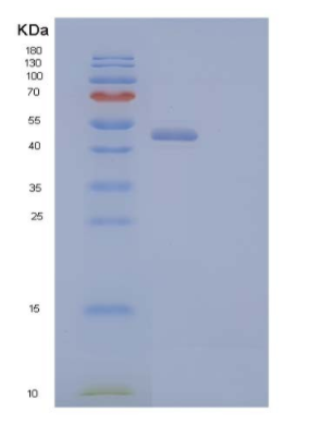 Recombinant Human Corneodesmosin/CDSN Protein(C-6His),Recombinant Human Corneodesmosin/CDSN Protein(C-6His)