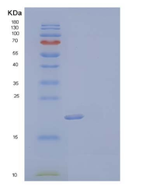 Recombinant Mouse Fms-LikeTyrosine Kinase 3 Ligand/FLT3LG Protein(C-6His),Recombinant Mouse Fms-LikeTyrosine Kinase 3 Ligand/FLT3LG Protein(C-6His)