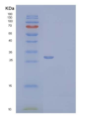 Recombinant Human Complement Factor H-Related Protein 2/CFHR2 Protein(C-6His),Recombinant Human Complement Factor H-Related Protein 2/CFHR2 Protein(C-6His)