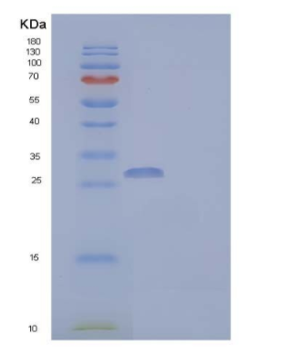 Recombinant Human Coronin-6/CORO6 Protein(N-6His),Recombinant Human Coronin-6/CORO6 Protein(N-6His)