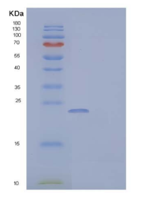 Recombinant Mouse IGF Binding Protein 6/IGFBP-6 Protein(C-6His),Recombinant Mouse IGF Binding Protein 6/IGFBP-6 Protein(C-6His)