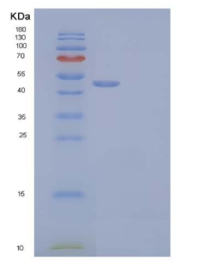 Recombinant Human Ornithine Decarboxylase/ODC1 Protein(C-6His, N-T7 tag),Recombinant Human Ornithine Decarboxylase/ODC1 Protein(C-6His, N-T7 tag)