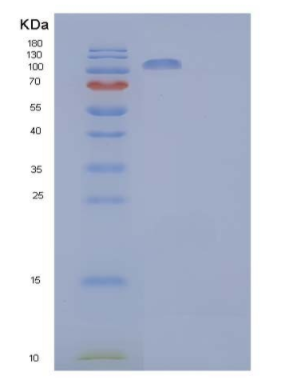 Recombinant Human Contactin-2/CNTN2/TAG-1 Protein(C-6His),Recombinant Human Contactin-2/CNTN2/TAG-1 Protein(C-6His)