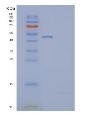 Recombinant Human Pancreatic Lipase-Related Protein 2/PLRP2 Protein(C-6His),Recombinant Human Pancreatic Lipase-Related Protein 2/PLRP2 Protein(C-6His)