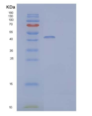 Recombinant Human IL-22 Receptor Subunit α2/IL-22BP/IL-22RA2 Protein(C-Fc),Recombinant Human IL-22 Receptor Subunit α2/IL-22BP/IL-22RA2 Protein(C-Fc)