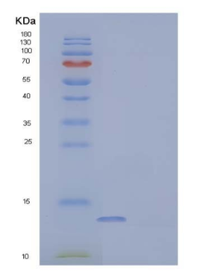 Recombinant Human Parvalbumin ?±/PVALB Protein(C-6His),Recombinant Human Parvalbumin ?±/PVALB Protein(C-6His)