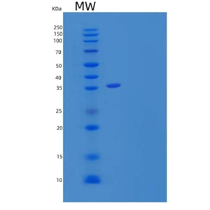 Recombinant Human Sulfotransferase 1A2/SULT1A2 Protein(N-6His),Recombinant Human Sulfotransferase 1A2/SULT1A2 Protein(N-6His)