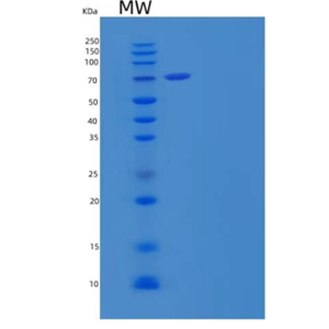 Eukaryotic Carcinoembryonic Antigen (CEA),Eukaryotic Carcinoembryonic Antigen (CEA)