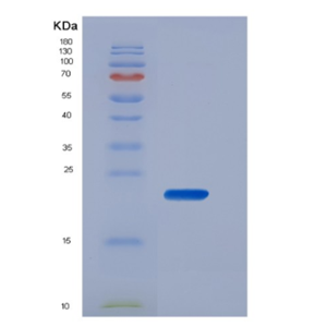 Recombinant Human CD16b / FCGR3B Protein (His tag)