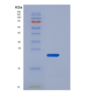 Recombinant Human CD16b / FCGR3B Protein (His tag),Recombinant Human CD16b / FCGR3B Protein (His tag)