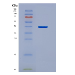 Recombinant Hepatoma Derived Growth Factor (HDGF),Recombinant Hepatoma Derived Growth Factor (HDGF)