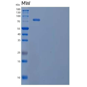 Recombinant Human Clusterin/ApoJ Protein(C-Fc-6His)