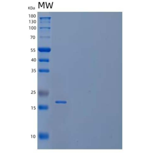 Recombinant Human Nucleolar Protein Family A Member 2/NHP2/NOLA2 Protein(N-6His)