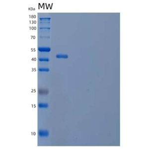 Recombinant Human NKG2D Ligand 2/NKG2DL2/N2DL2 Protein(C-Fc)