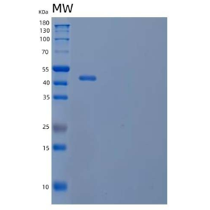 Recombinant Human Coagulation Factor IX/F9 Protein(C-6His)