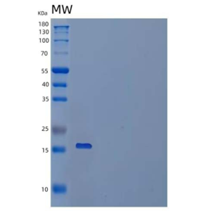 Recombinant Mouse IAP/OA3/CD47 Protein(C-6His)