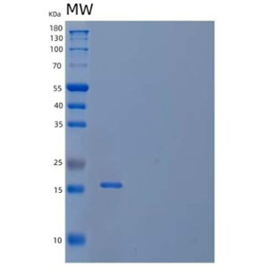 Recombinant Human NPDC1/CAB1 Protein(C-6His),Recombinant Human NPDC1/CAB1 Protein(C-6His)