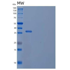 Recombinant Mouse CD5 antigen-like Protein.