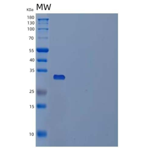 Recombinant Human Palmitoyl-Protein Thioesterase 1/PPT1 Protein(C-6His)