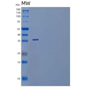 Recombinant Mouse IL-1 Receptor-Like 1/IL-1RL1/IL-1 R4 Protein(C-6His),Recombinant Mouse IL-1 Receptor-Like 1/IL-1RL1/IL-1 R4 Protein(C-6His)