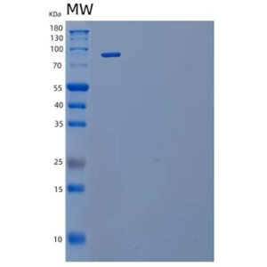 Recombinant Mouse IL-12 Receptor Subunit β2/IL-12RB2 Protein(C-Fc)