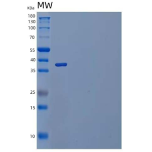 Recombinant Human IL-23 Recetor/IL-23R Protein(C-6His)