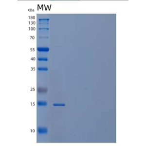 Recombinant Human PDCD5/TFAR19 Protein(N-6His),Recombinant Human PDCD5/TFAR19 Protein(N-6His)