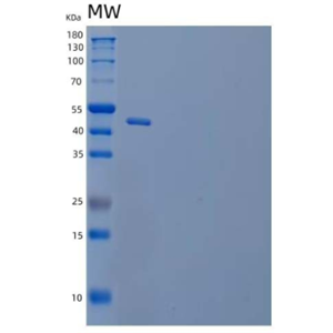 Recombinant Human Tumor Necrosis Factor Receptor II/TNFRSF1B/CD120b Protein(C-Fc),Recombinant Human Tumor Necrosis Factor Receptor II/TNFRSF1B/CD120b Protein(C-Fc)