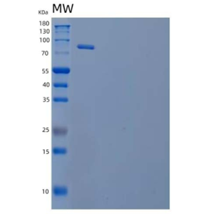 Recombinant Human Periostin/OSF-2 Protein(C-6His)