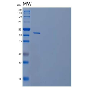 Recombinant Human 4-1BB Ligand/4-1BBL/TNFSF9/CD137L Protein(N-Fc)