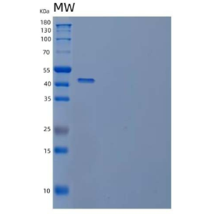 Recombinant Human Cystathionine γ-Lyase/CTH Protein