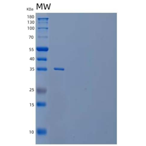 Recombinant Human TWEAK Receptor/TWEAK R/TNFRSF12A Protein(C-Fc)