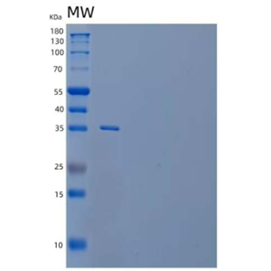 Recombinant Human TWEAK Receptor/TWEAK R/TNFRSF12A Protein(C-Fc),Recombinant Human TWEAK Receptor/TWEAK R/TNFRSF12A Protein(C-Fc)