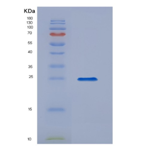 Eukaryotic Interleukin 17 (IL17)